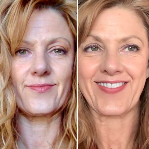 Face Yoga before and after